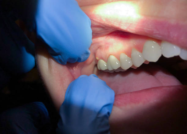 Best Same-Day Emergency Dentist in Queensland, MD